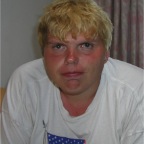 050720_Mick-Sunburn2