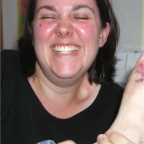 050630_MelWithBrokenToe