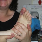 050630_MelWithBrokenToe2