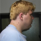 050530_MickBleached3