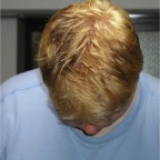 050530_MickBleached5